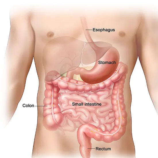 Gastrointestinal Stromal Tumour - Symptoms, Types, Causes & Diagnosis